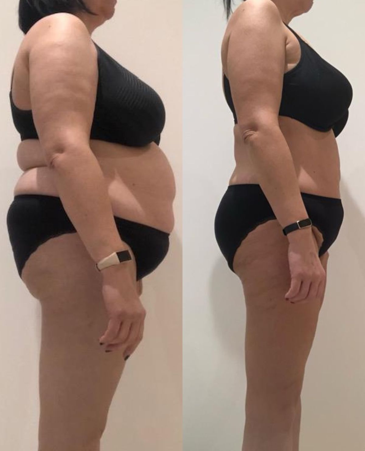should i take tirzepatide on an empty stomach Tirzepatide and Meals: Empty Stomach Dosing Guidelines – PlexusDx